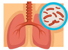 Homeopathic solutions for Respiratory Issues